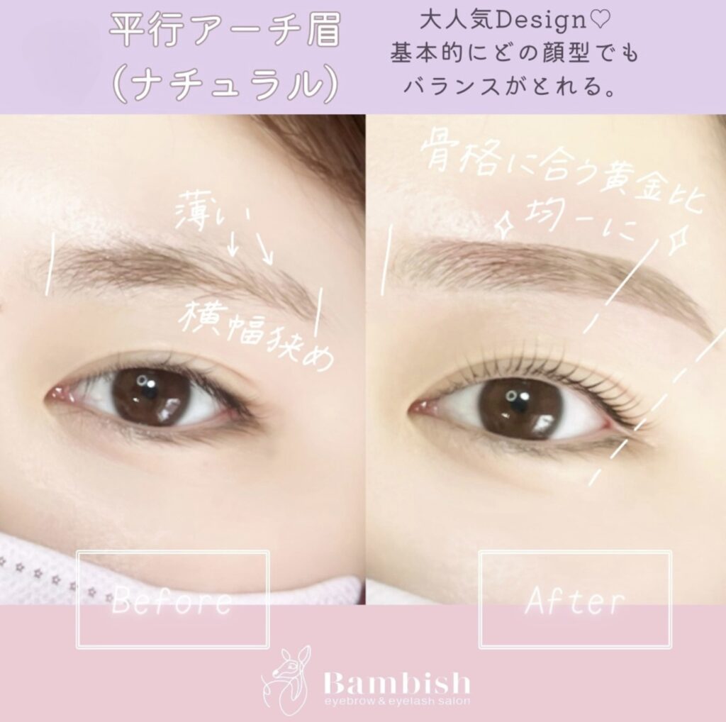 バンビッシュ 平行アーチ