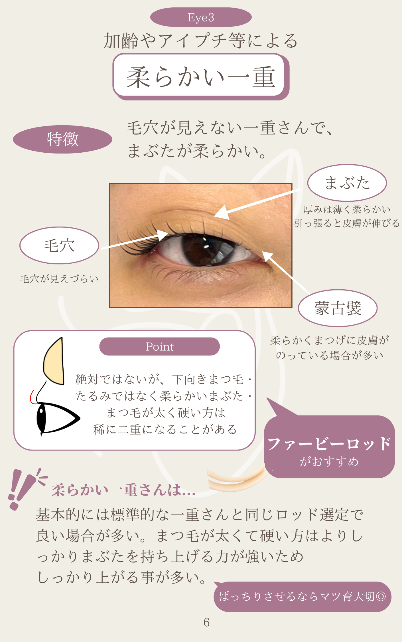 柔らかい一重の一重まぶたデザイン解説画像
