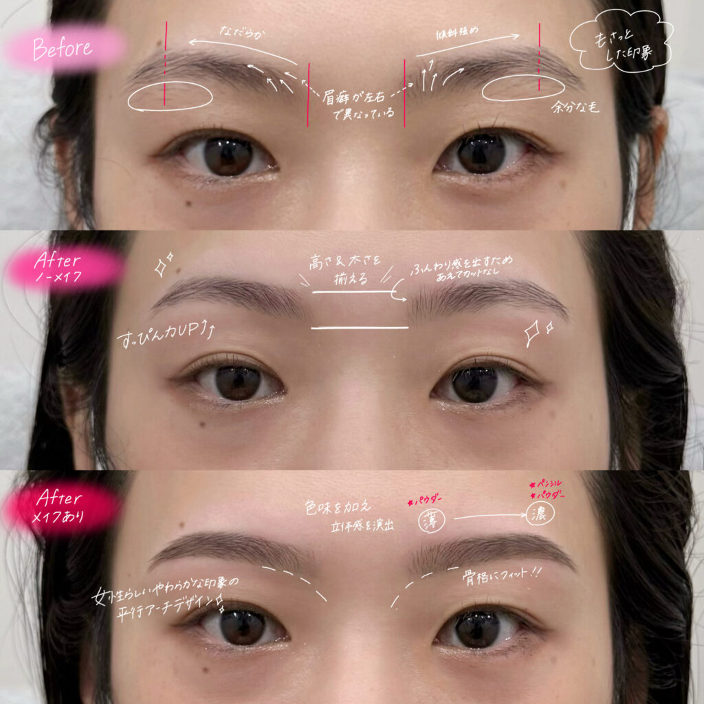 バンビッシュ　増田　ビフォーアフター